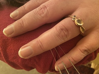 Personalized Treatment