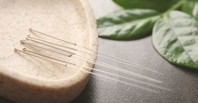 Nervous About Trying Acupuncture for the First Time? Here’s What to Expect