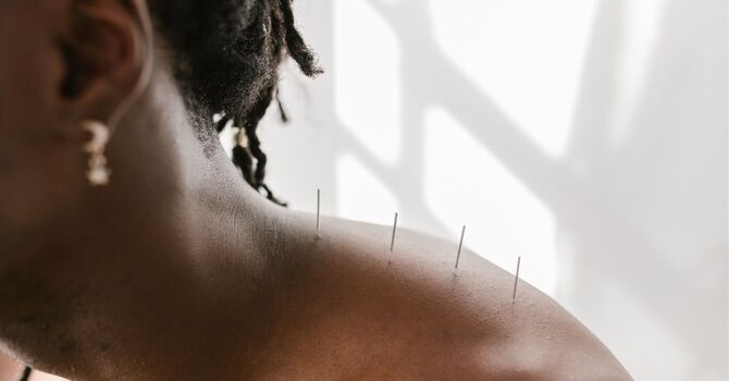 Nervous About Trying Acupuncture for the First Time? Here’s What to Expect
